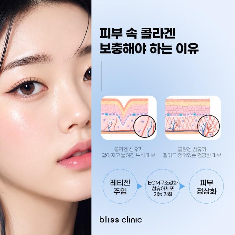 레티젠 콜라겐 효과는 물론 부작용에 관한 모든 것 관련 이미지 4