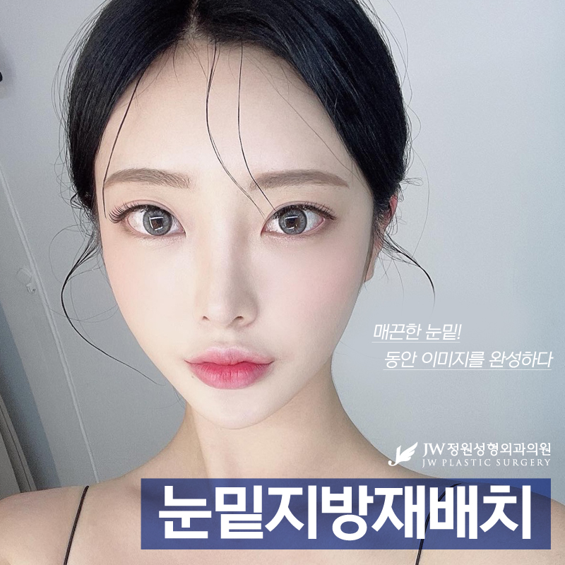 눈밑지방재배치병원 어둑한 눈가를 밝게 관련 이미지 1