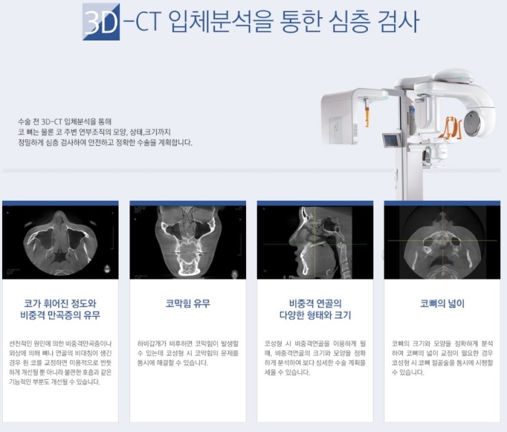 촌스러운 이미지의 복코, JW정원성형외과 복코교정으로 세련되게! 관련 이미지 5