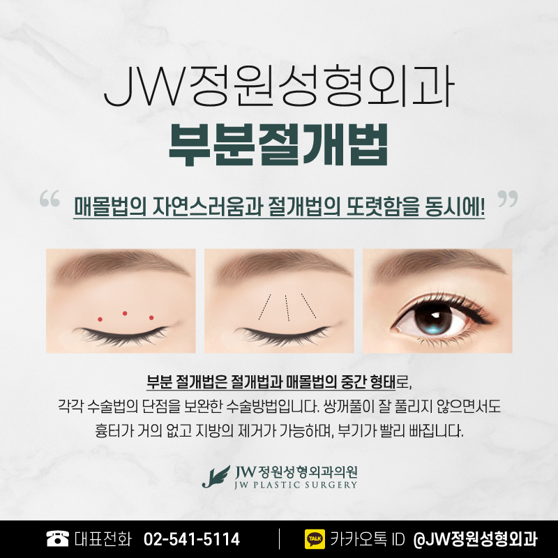 눈성형잘하는병원 크고 예쁜 눈으로 【강남 JW정원성형외과】 관련 이미지 5
