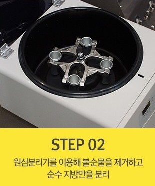 세월의 흔적을 감추는 매끈한 손등! JW정원성형외과 손등지방이식 관련 이미지 3