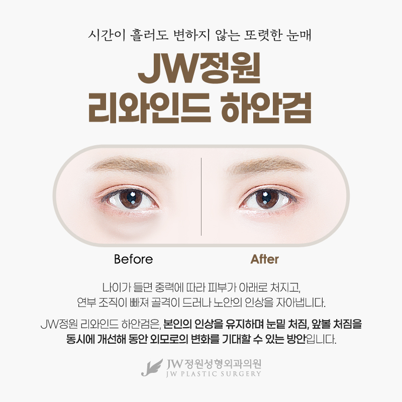 Lower Eyelid Surgery Clinic for Making Bulging Under-Eyes More Even image 2