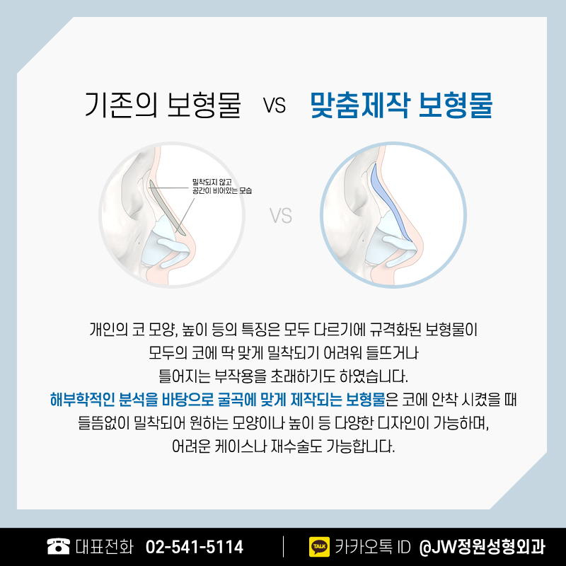 코수술병원 높은 콧대를 바란다면 관련 이미지 4