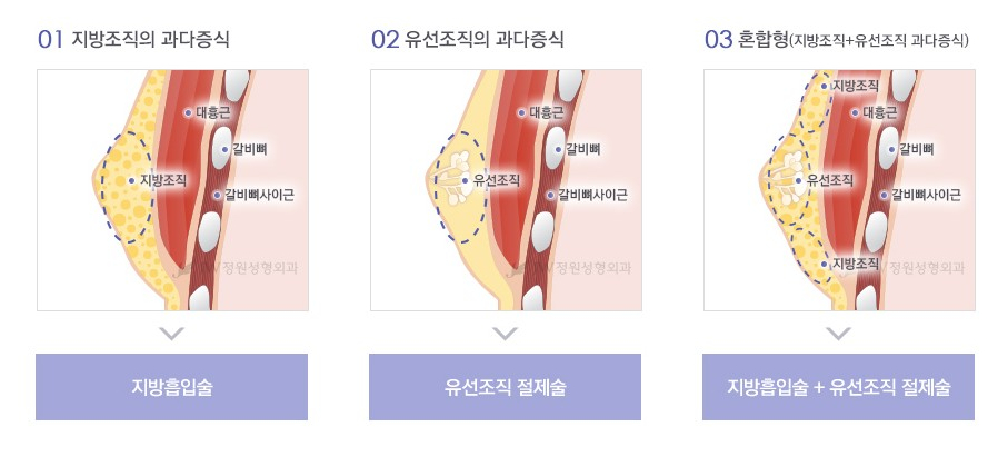 남모를 고민 관련 이미지 5
