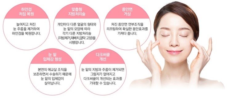 환한 눈매와 동안 얼굴을 동시에, JW정원성형외과 REWIND 하안검 관련 이미지 2
