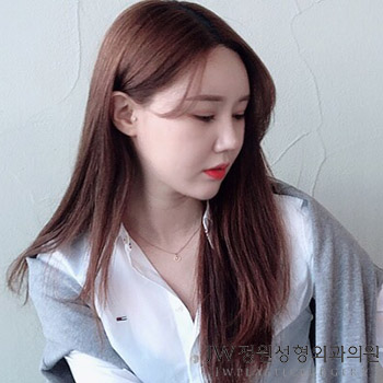 밋밋한 콧대, 3D 보형물로 원하는 만큼 높일 수 있다고? JW정원 3D보형물 코성형으로 알아봐요 관련 이미지 2