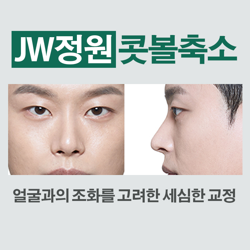 촌스러움 노노! 세련된 라인, JW정원성형외과 콧볼축소 관련 이미지 4