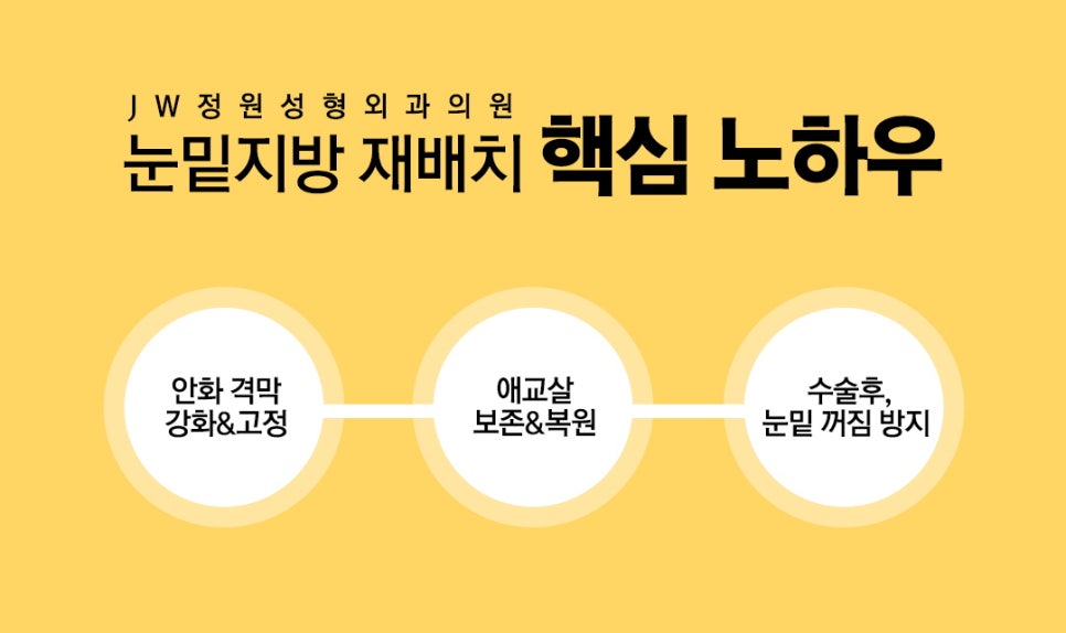 다크서클, 눈밑지방재배치로 탄력있는 동안 눈매 완성 관련 이미지 3