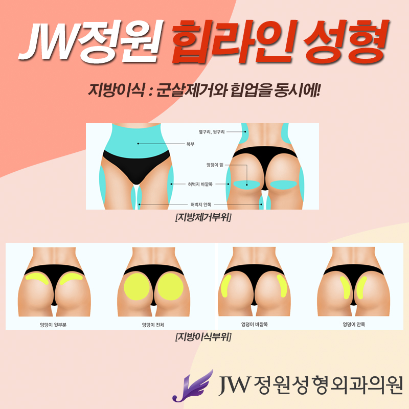Perfect S-Line, Completed with JW Garden Hip Line Surgery image 4