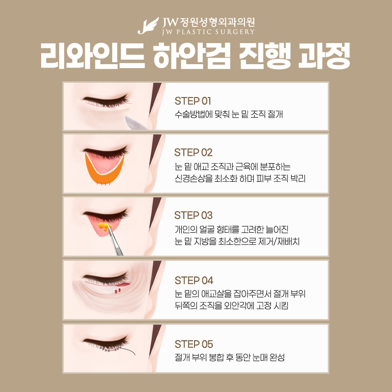 하안검가격 중안면 거상까지 원한다면 관련 이미지 3