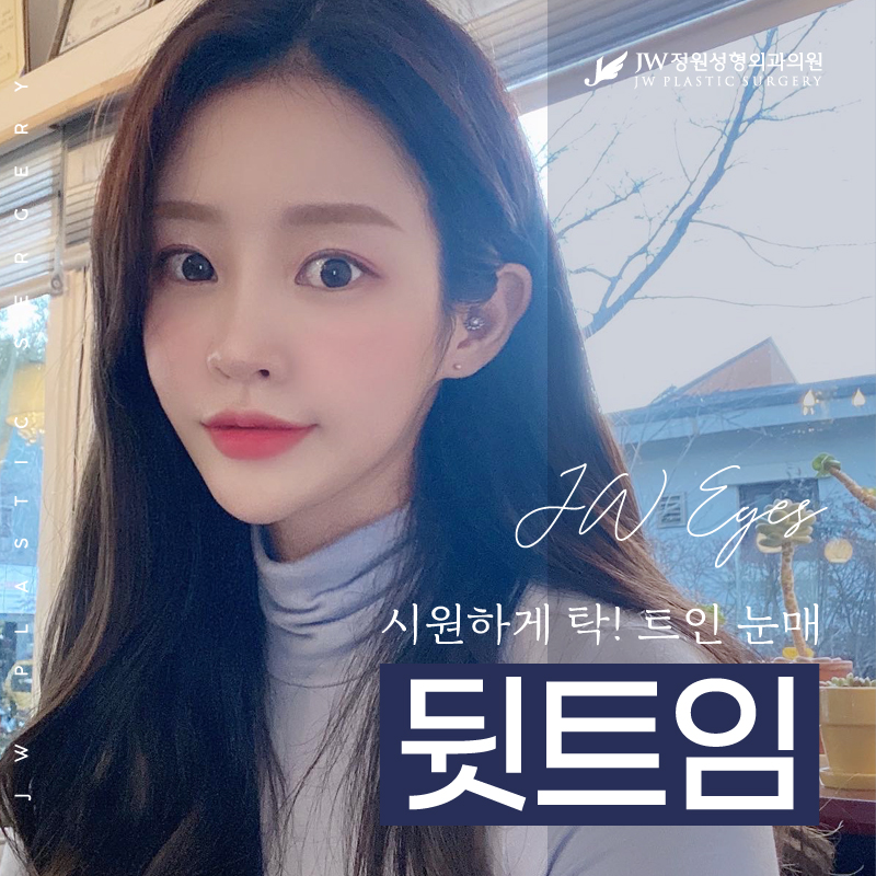 뒷트임수술 시원하게 탁 트인 눈매 관련 이미지 1