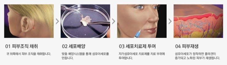 탄력 있고 매끈한 피부 JW정원성형외과 큐어스킨으로 관련 이미지 3