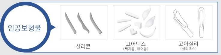 [JW정원성형외과] 코성형, 나에게 적합한 보형물은? 관련 이미지 4