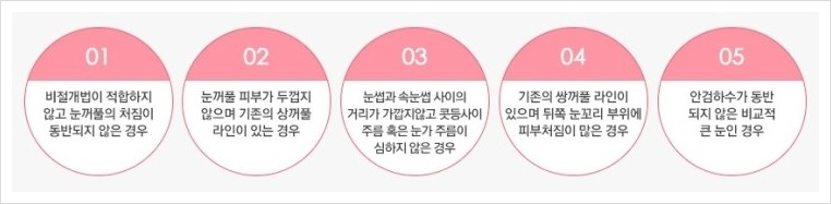 [JW정원성형외과] 처진 눈꺼풀 늘어진 지방과 주름 제거 상안검 수술로 해결 관련 이미지 3