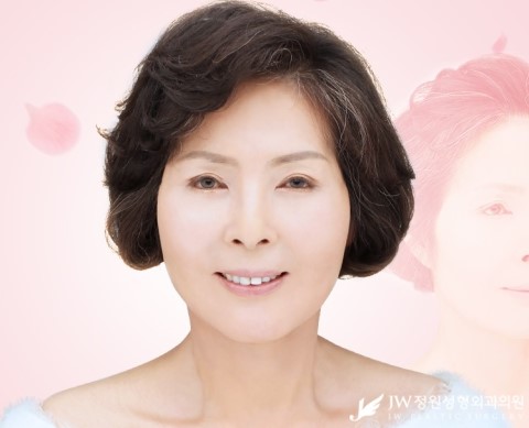 [JW정원성형외과] 실리프팅으로 나잇살 흔적 없이 지우자! 관련 이미지 4