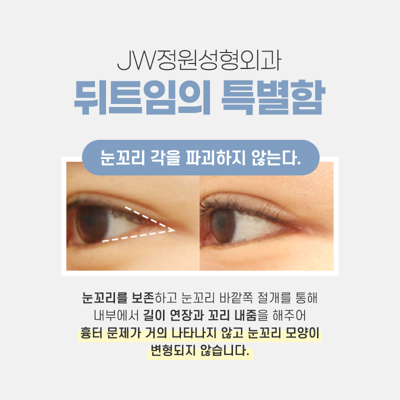 Carefully Check the Cost of Lateral Canthoplasty image 3