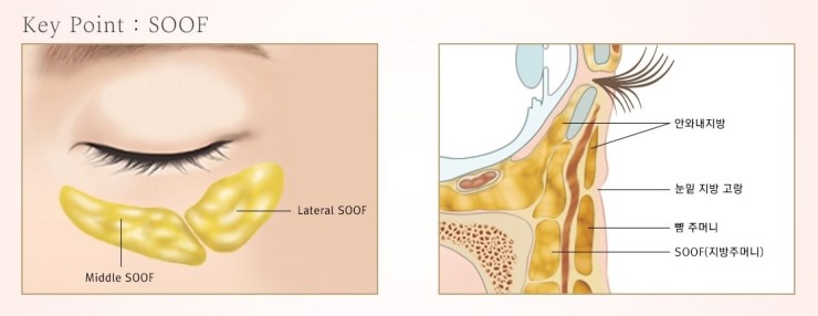 JW Garden Lower Blepharoplasty to Meet the Younger Me Again image 5