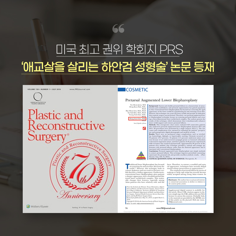 하안검비용 어두운 다크서클이 고민이라면 관련 이미지 5
