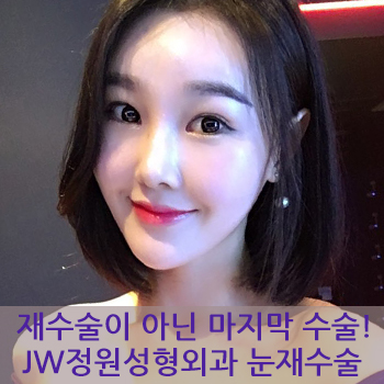 재수술이 아닌 마지막 수술! JW정원성형외과 눈재수술 관련 이미지 1