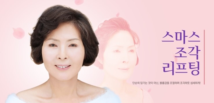 JW정원성형외과 안면거상술▶ 스마스조각리프팅이란? 관련 이미지 4