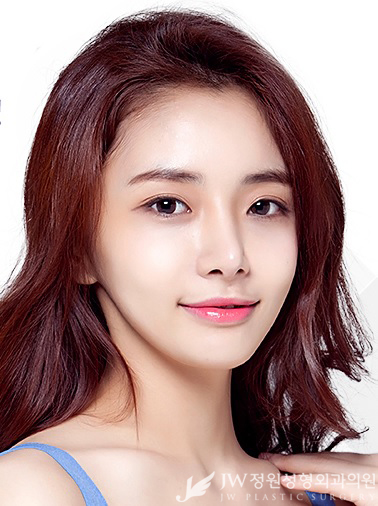 묵은 각질과 모공 속 노폐물 제거! JW정원성형외과 아쿠아필로 말끔하게! 관련 이미지 4