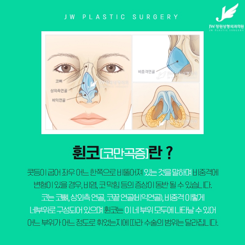 지긋지긋한 비염, 기능 코성형으로 라인까지 예쁘게 관련 이미지 5
