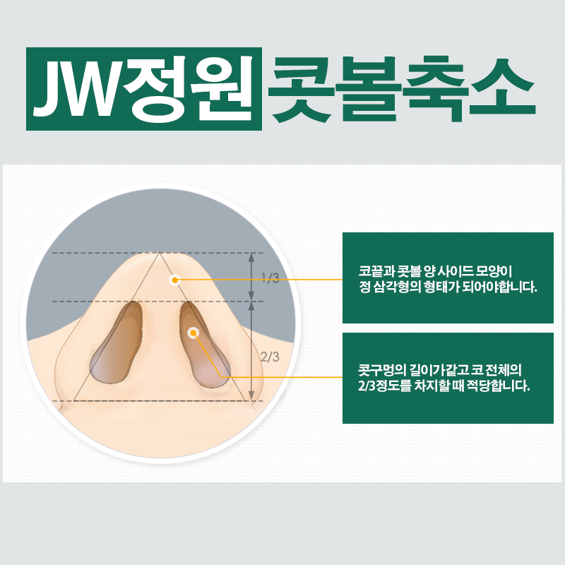 촌스러움 노노! 세련된 라인, JW정원성형외과 콧볼축소 관련 이미지 2