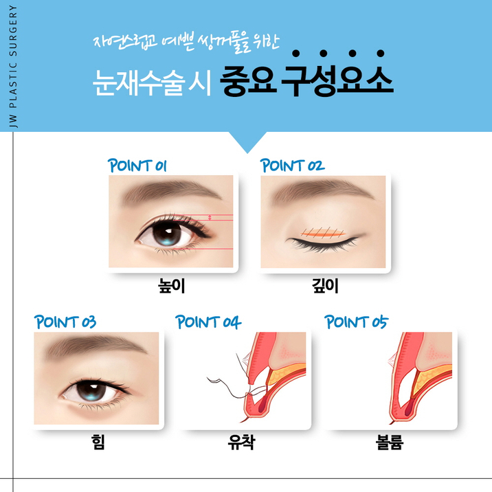 쌍꺼풀재수술잘하는곳 이번이 마지막 눈재수술이다! 관련 이미지 4