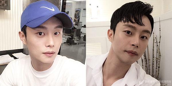 눈+코 성형으로 남성적인 이미지 UP 남자성형도 역시 JW정원성형외과! 관련 이미지 4