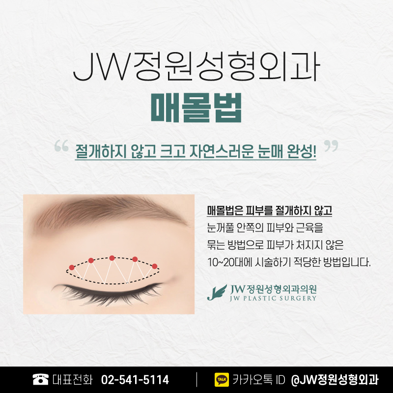 쌍수잘하는곳 자연스러운 화려한 눈매를 바란다면 관련 이미지 3