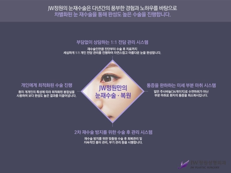 [JW정원성형외과] 앞뒷트임 재수술.복원 알아본다면? 트임복원 잘하는 곳에서! 관련 이미지 7