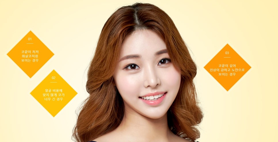 강한 인상을 부드럽게, JW정원 화살코/긴코 성형 관련 이미지 9