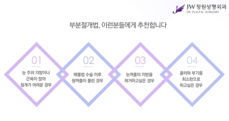 [JW정원성형외과] 나에게 맞는 눈성형 찾기! 관련 이미지 8