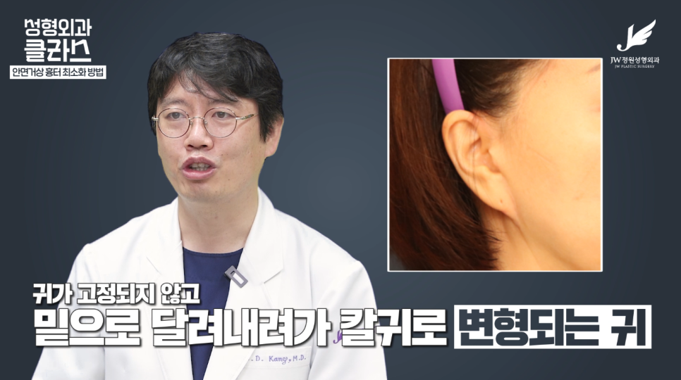 안면거상술후기 흉터 걱정 없이 깔끔하게!  【강남 JW정원성형외과】 관련 이미지 15