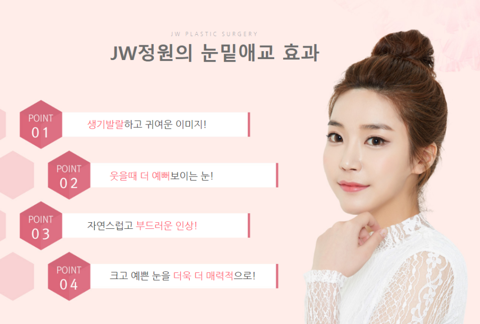 정원 눈밑애교살수술, 눈밑 볼륨을 채워 생기있고 귀엽게! 관련 이미지 4