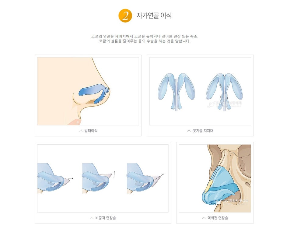 Best Place for Tip Rhinoplasty, See the Natural Results in a Tip Rhinoplasty Review image 7