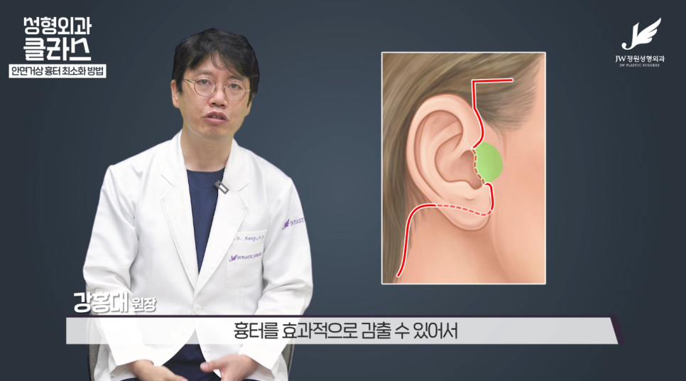 안면거상술후기 흉터 걱정 없이 깔끔하게!  【강남 JW정원성형외과】 관련 이미지 6