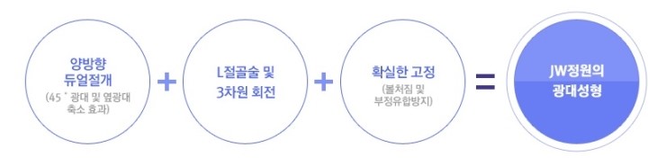 어느 각도에서도 부드럽고 아름다운 얼굴라인! JW정원성형외과 광대축소술로 관련 이미지 2