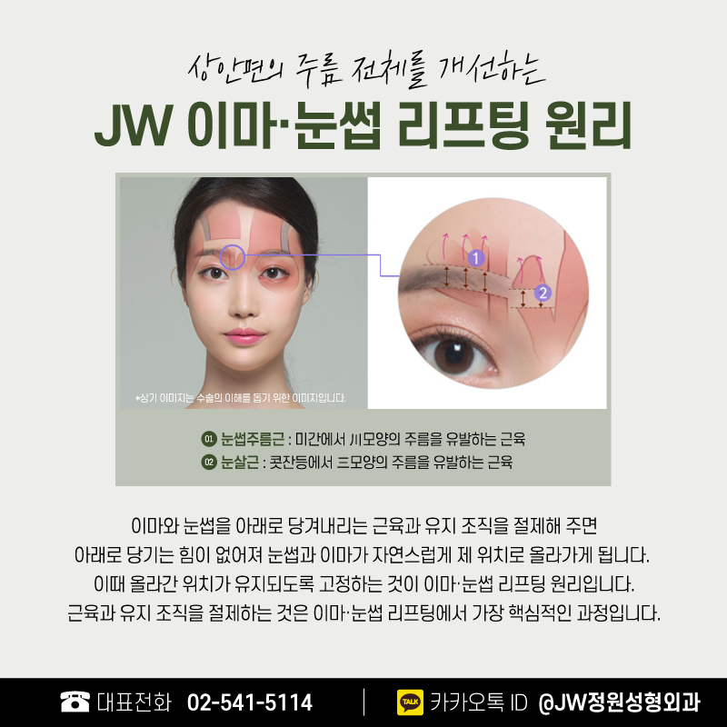 이마거상술비용 노화,주름? 이제는 안녕! 【강남 JW정원성형외과】 관련 이미지 3