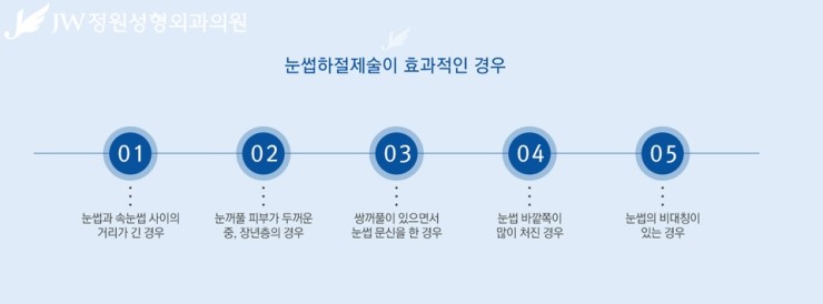 [JW정원성형외과] 처진 눈꺼풀을 탄력 있는 눈매로! 상안검성형 관련 이미지 7
