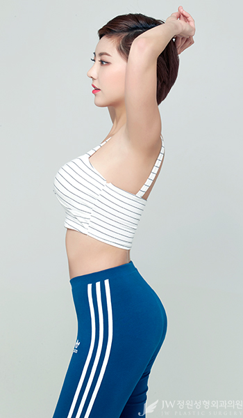 올해도 다이어트에 실패했다면? 늦기전에 JW정원성형외과 지방흡입으로! 관련 이미지 3