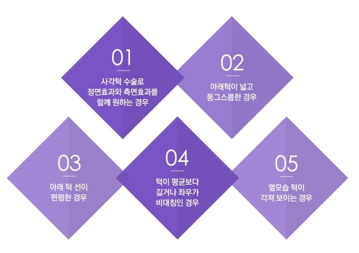 각진 얼굴 NO! JW정원성형외과 브이라인 성형으로 작고 갸름한 얼굴 완성 관련 이미지 7
