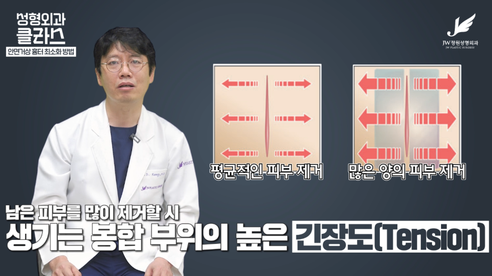 안면거상술후기 흉터 걱정 없이 깔끔하게!  【강남 JW정원성형외과】 관련 이미지 7