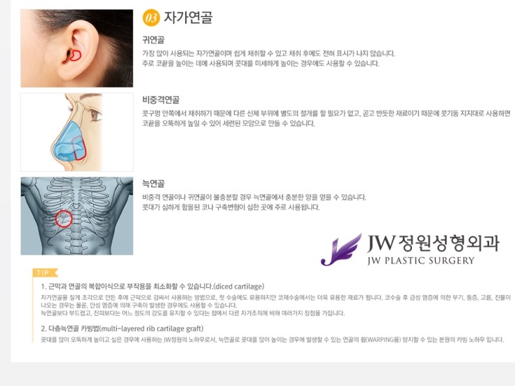 [JW정원성형외과] 낮은코를 개선해주는 낮은코성형 알아봐요! 관련 이미지 8