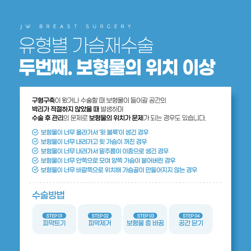 강남가슴재수술 어려울수록 자신 있는 곳에서 관련 이미지 4