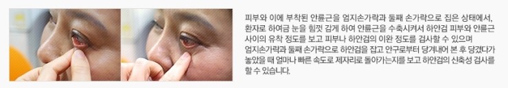 환한 눈매와 동안 얼굴을 동시에, JW정원성형외과 REWIND 하안검 관련 이미지 6