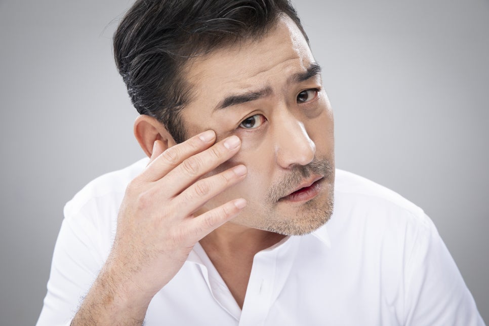 JW정원성형외과 더블리프팅(아큐스컬프&실리프팅)으로 피부 탄력과 브이라인 효과까지 더블로! 관련 이미지 4