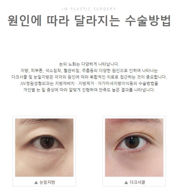 JW Garden’s Various Youthful Lifting Treatments! Which Lifting Type Is Right for My Age? image 15