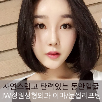 생기 있는 동안얼굴! JW정원성형외과 이마/눈썹 리프팅 관련 이미지 1