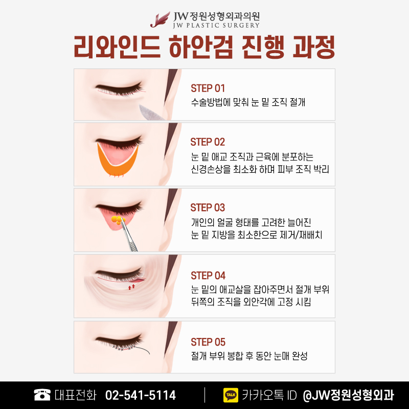 Distinct Changes Before and After Lower Blepharoplasty at 【Gangnam JW Garden Plastic Surgery】 image 5